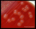streptococcus pyogenes